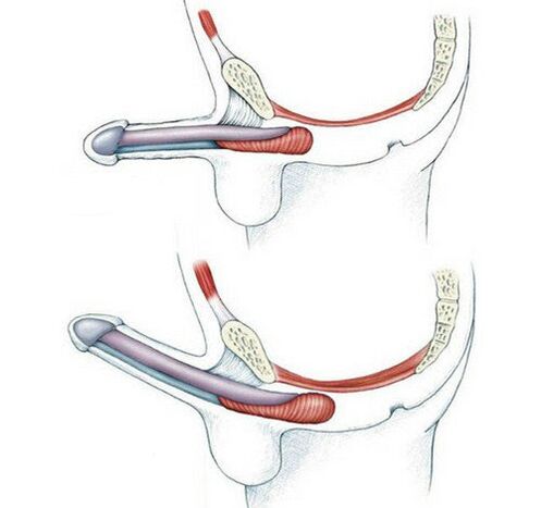 Penis without training the pubococcygeus muscle and after
