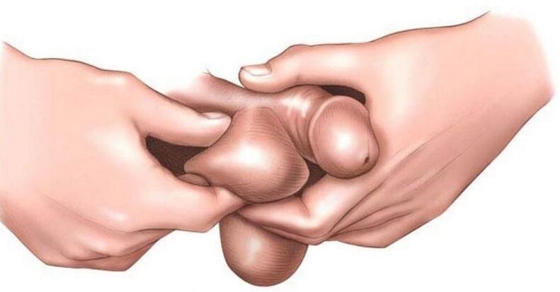 Why eggs are scratching in men